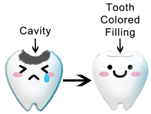 Diagram of dental cavity