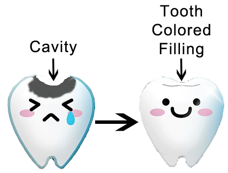 Diagram of dental cavity