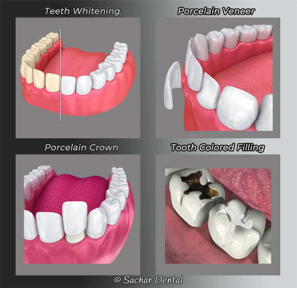 Cosmetic Dentist NYC diagram