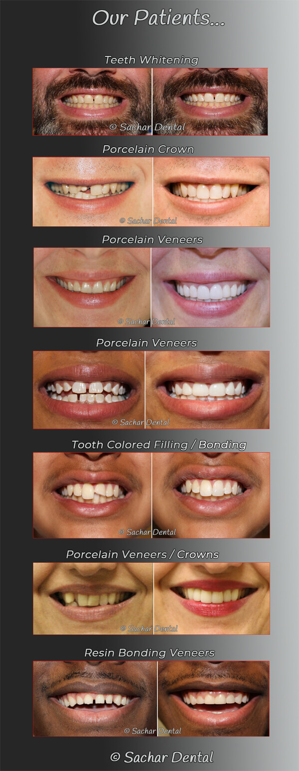 Cosmetic Dentistry NYC Pictures