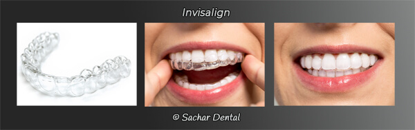 Invisalign dentist in New York City