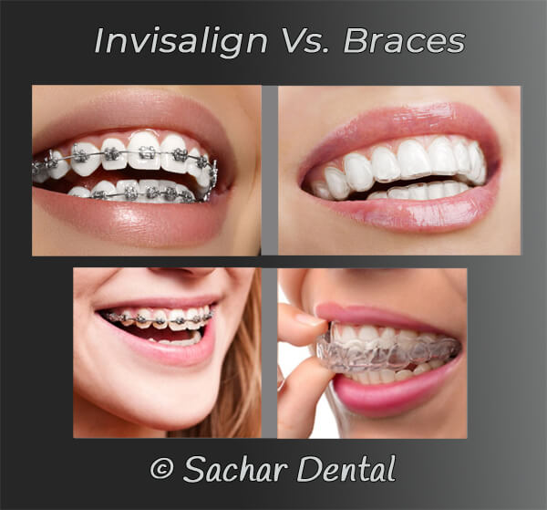 Top Invisalign Dentist NYC