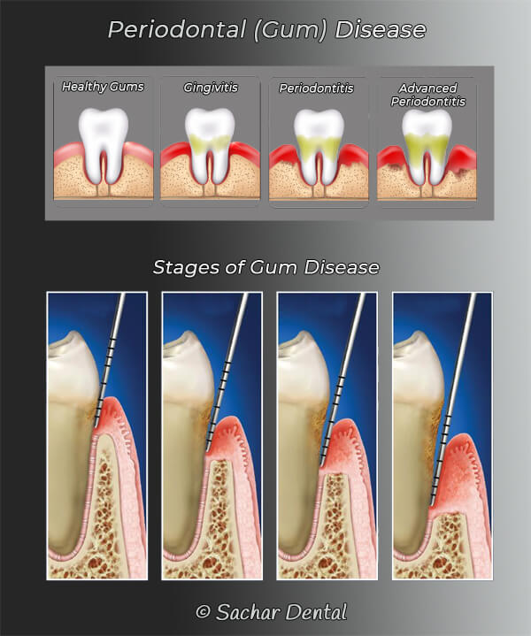 Periodontist NYC