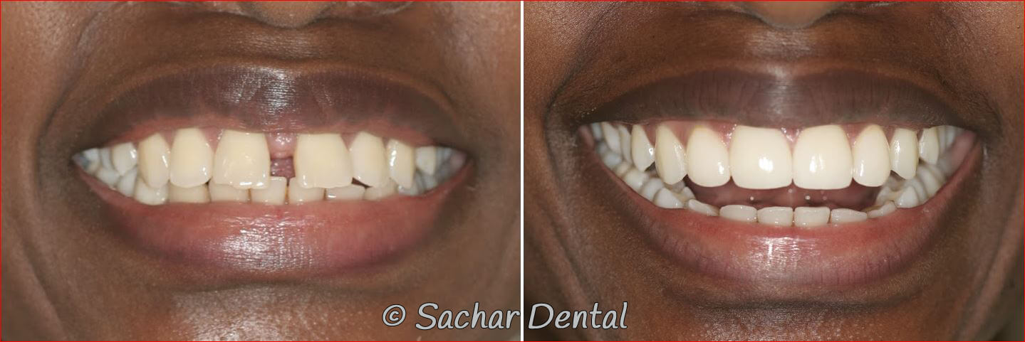 Sachar Dental NYC Cosmetic Dentistry
