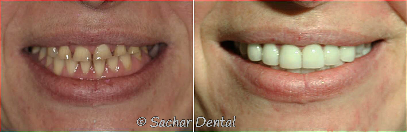 Cosmetic Dentistry NYC for complex cases