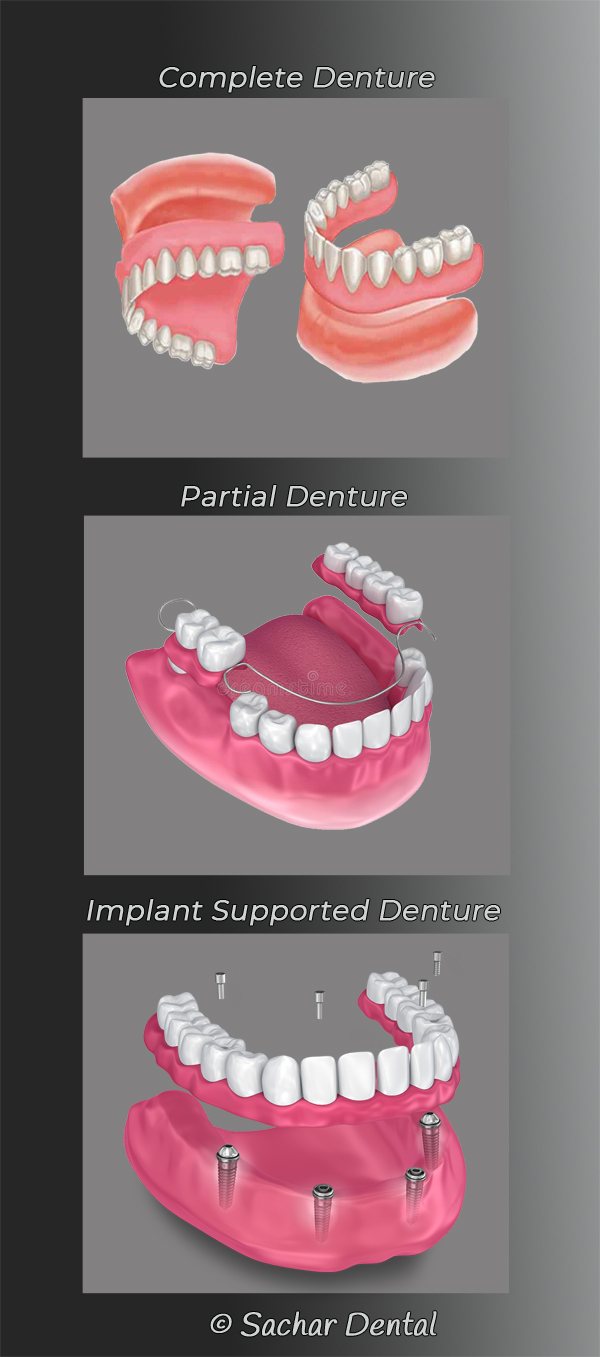 Dentist NYC for Dentures