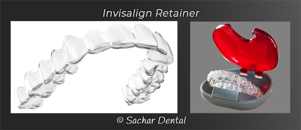 Dentist NYC invisalign retainer