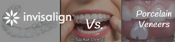 Picture of Invisalign trays and porcelain veneers in the background with text indicating Invisalign vs porcelain veneers