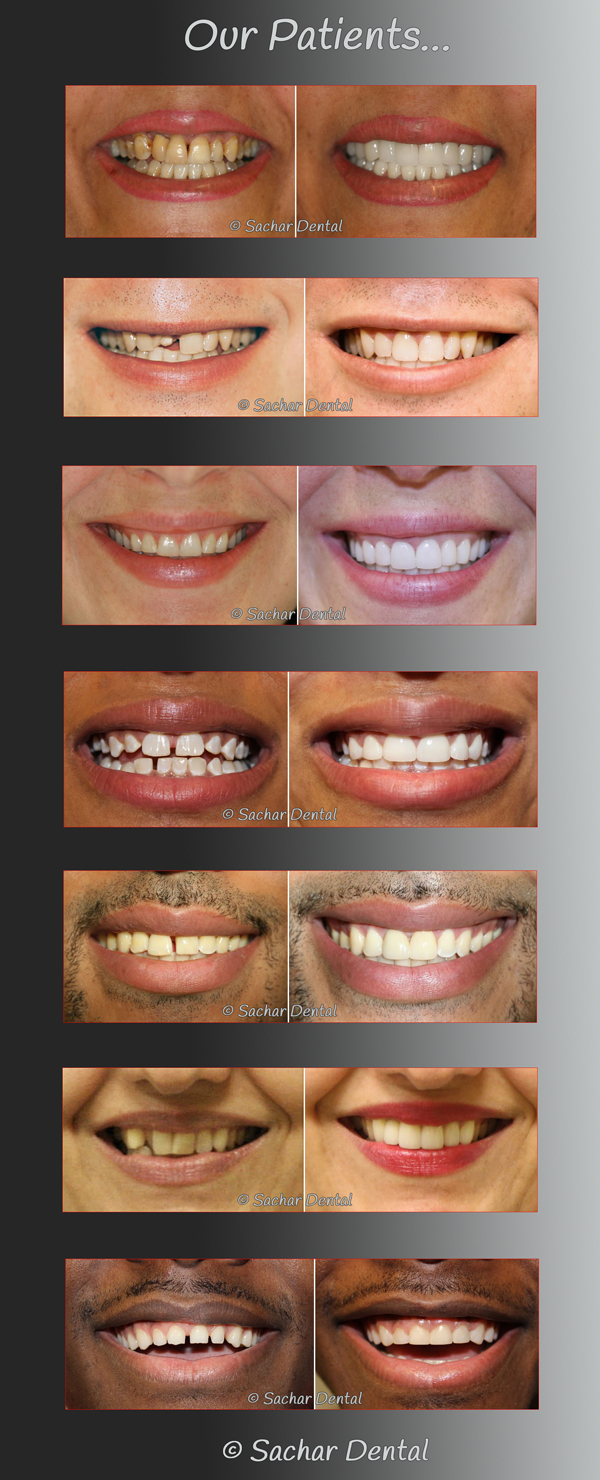 Smile Makeover NYC