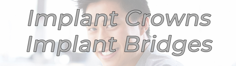 Dental implant crowns and Bridges NYC FAQ