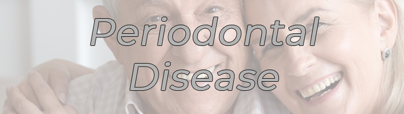 Periodontal disease NYC FAQ