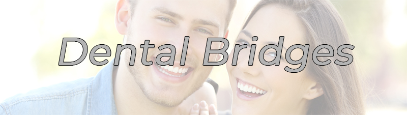 Dental Bridges FAQ