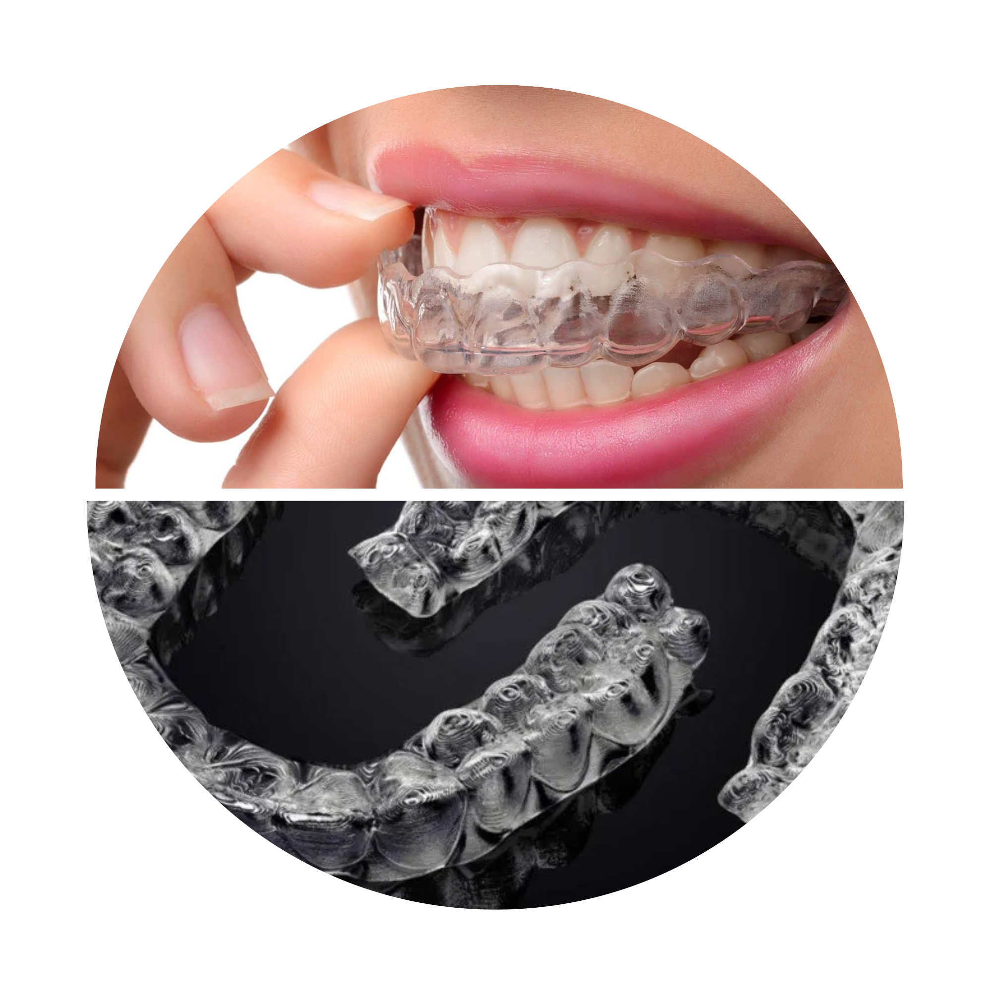 Invisalign NYC