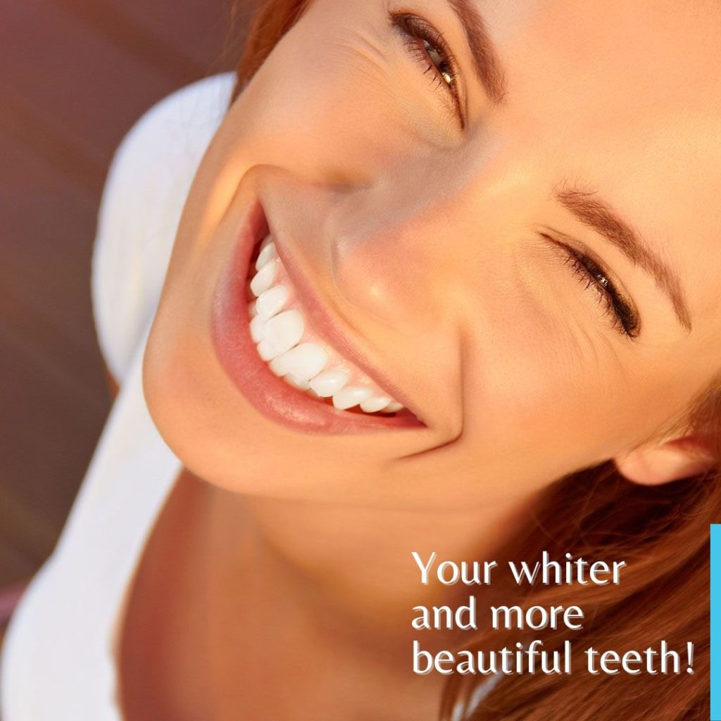 Teeth Whitening