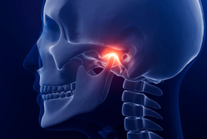 Illustration of TMJ inflammation for jaw pain treatment