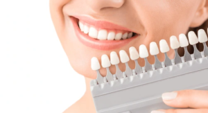 Cosmetic dentistry treatment showing brighter and whiter teeth