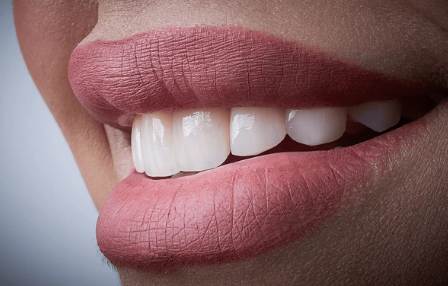 Beautiful Smile After Cosmetic Dental Treatments Close-up of a bright, natural smile after Top Cosmetic Dental Treatments showing healthy white teeth.