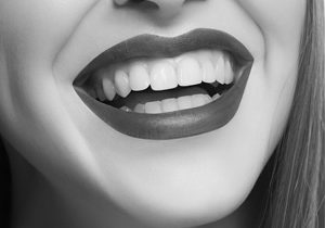 Dentist NYC for Cosmetic Dentistry